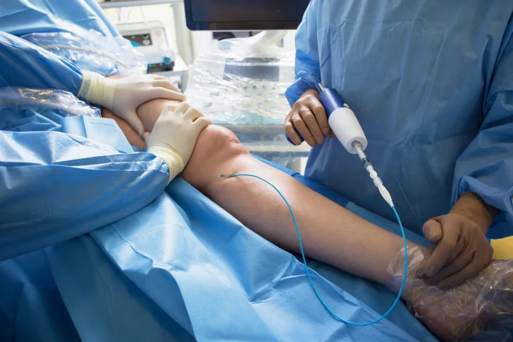 professional vein doctors doing a vein treatment