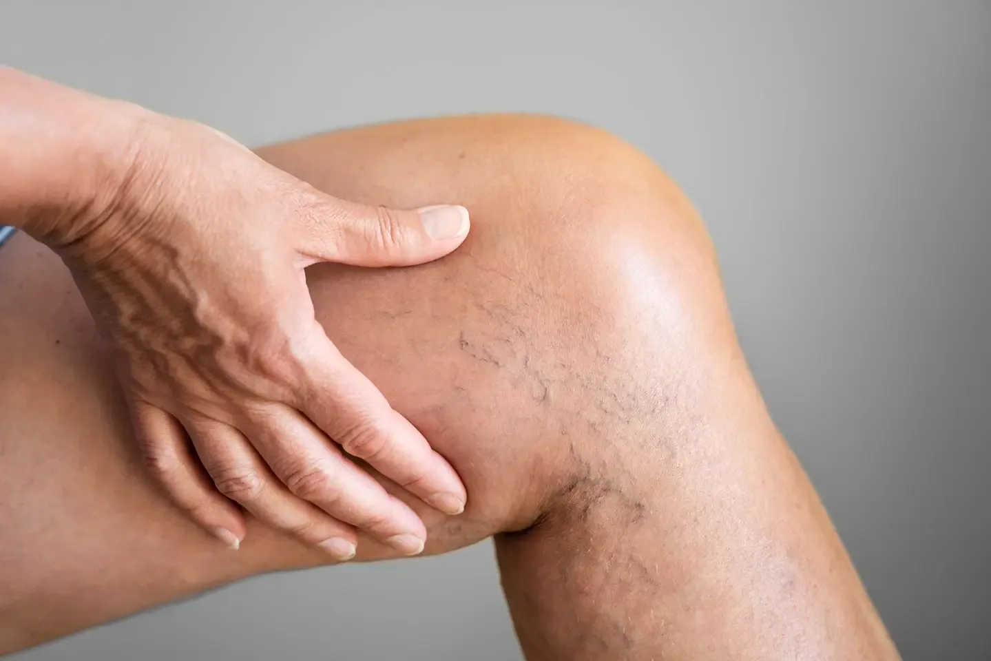 Ataxia Telangiectasia Late Onset: A Guide to Understanding