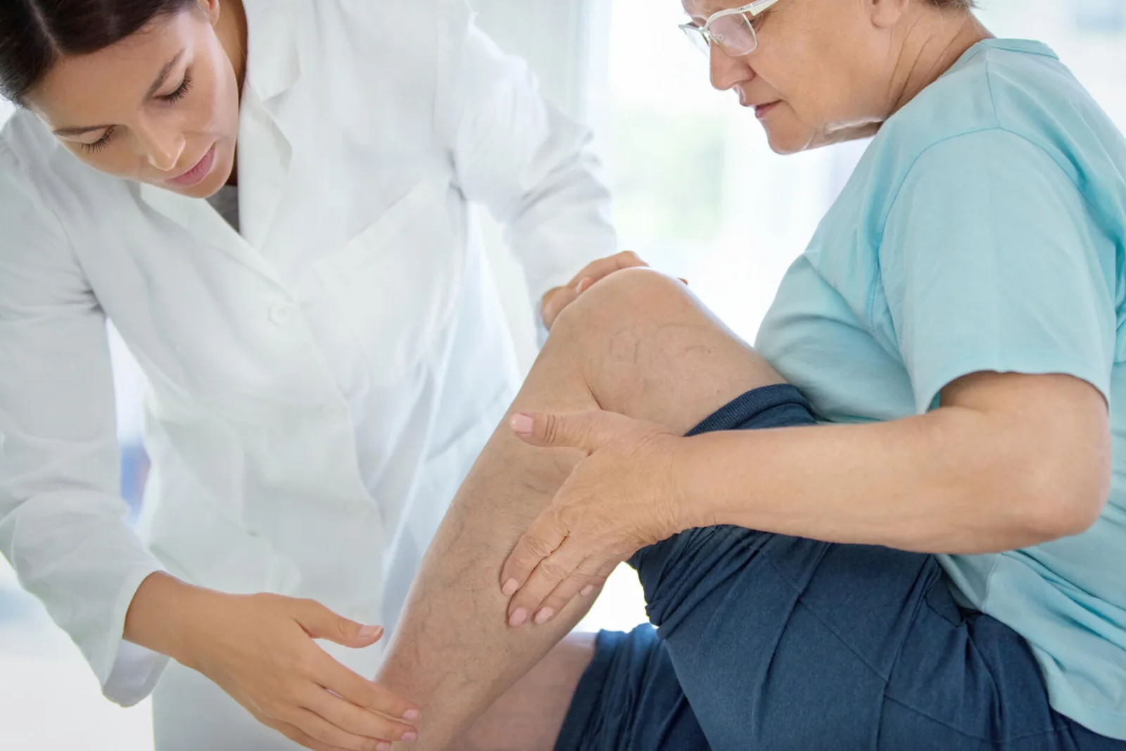 When to Worry About Varicose Veins